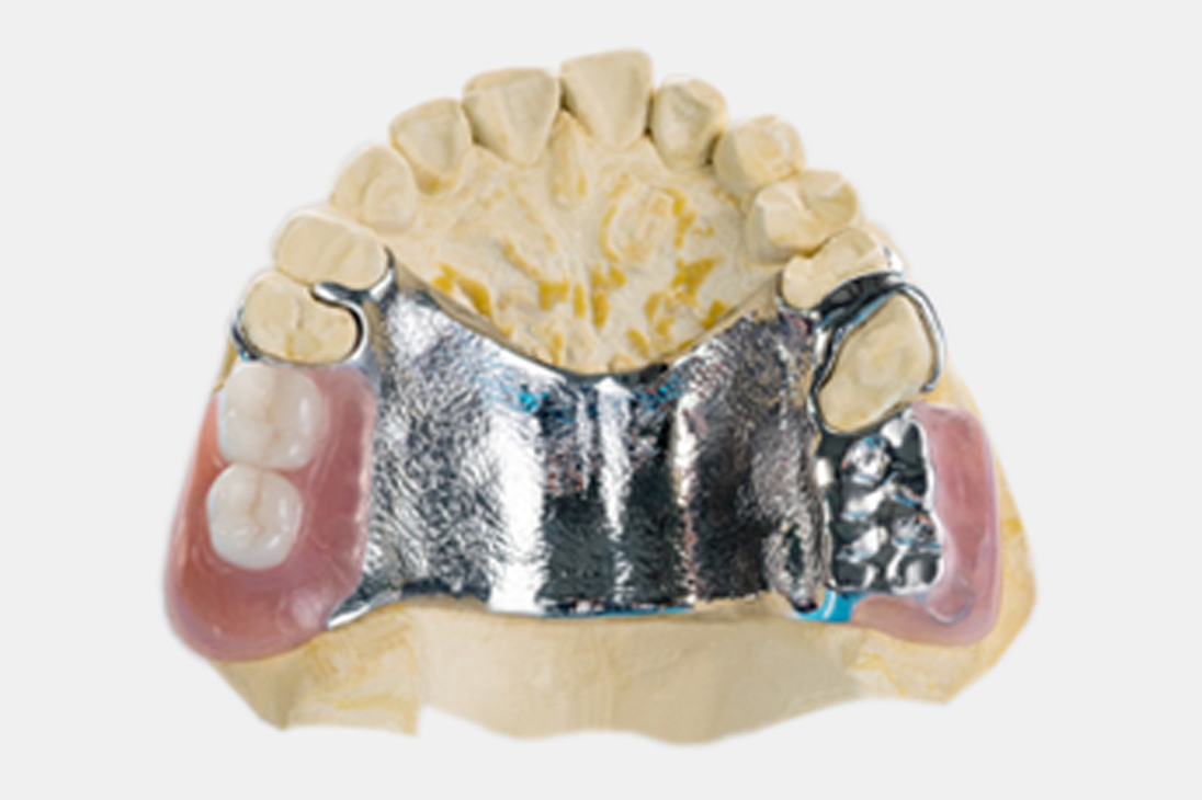 Chrome Cobolt Denture