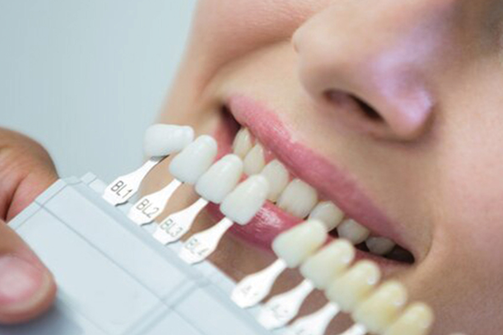 composite denture